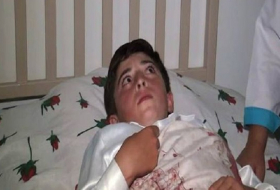 Армяне обстреляли Товуз, ранен 13-летний ребенок