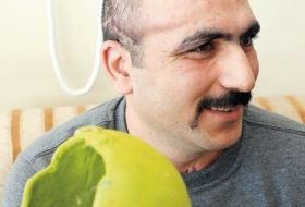 Раненному в апрельских боях азербайджанскому военнослужащему вживили имплант черепа (ФОТО) 