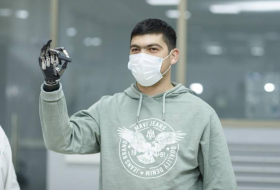 Минтруда Азербайджана обеспечило высокотехнологичными протезами 157 ветеранов